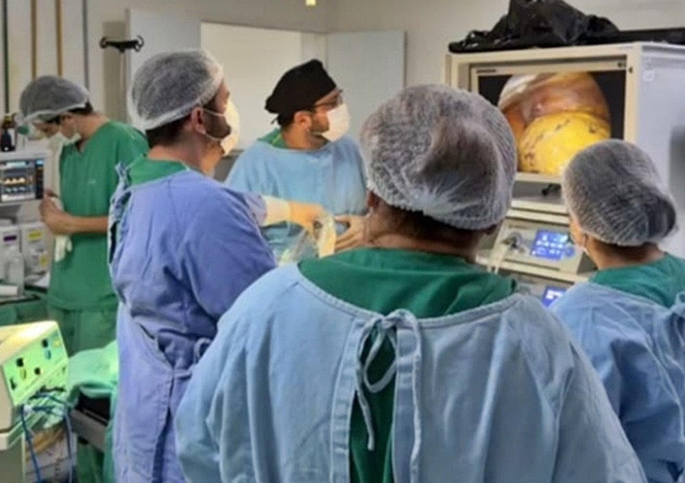 Hospital de Patos realiza cirurgia oncológica por videolaparoscopia em paciente com câncer de cólon