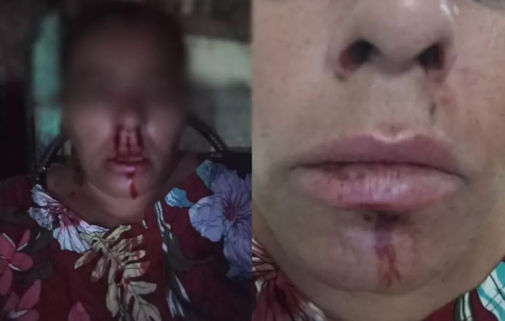 Mulher é agredida por primo ao intervir em discussão familiar no bairro Novo Horizonte, em Patos